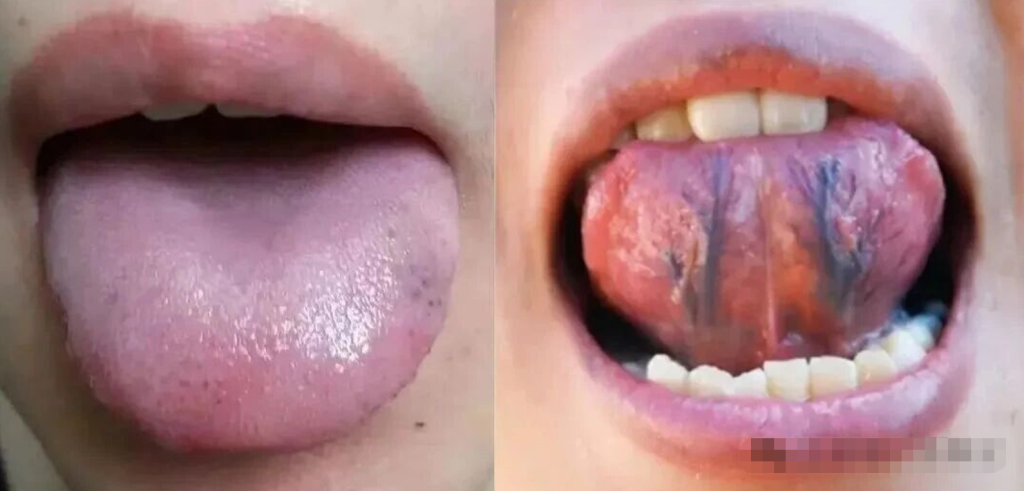 图片[10]-中医看舌头，到底在看什么？-智健家