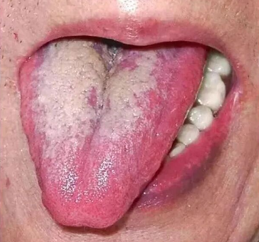 图片[11]-中医看舌头，到底在看什么？-智健家