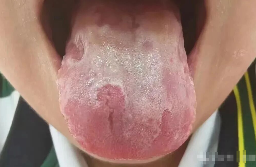 图片[12]-中医看舌头，到底在看什么？-智健家