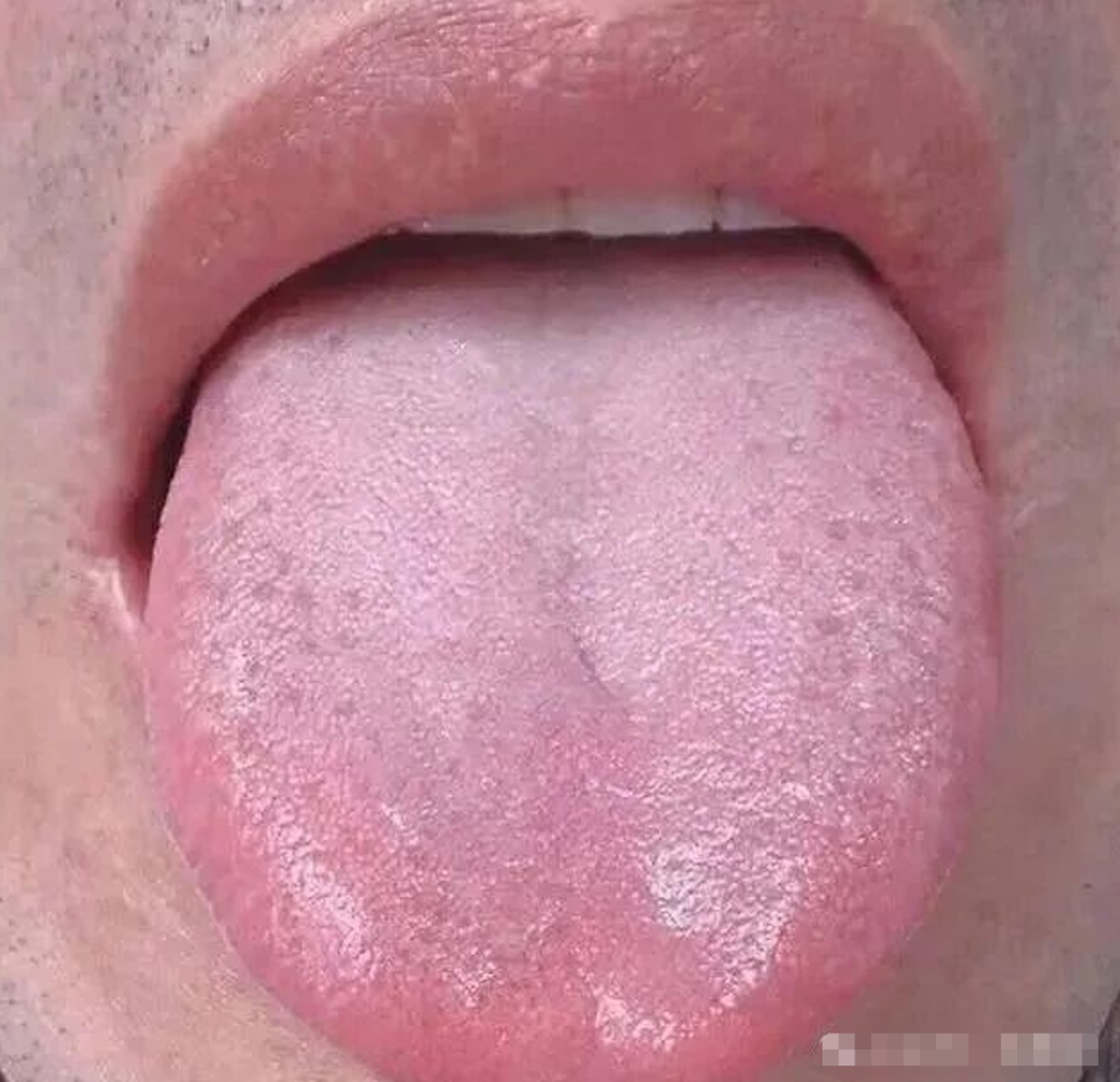 图片[2]-中医看舌头，到底在看什么？-智健家