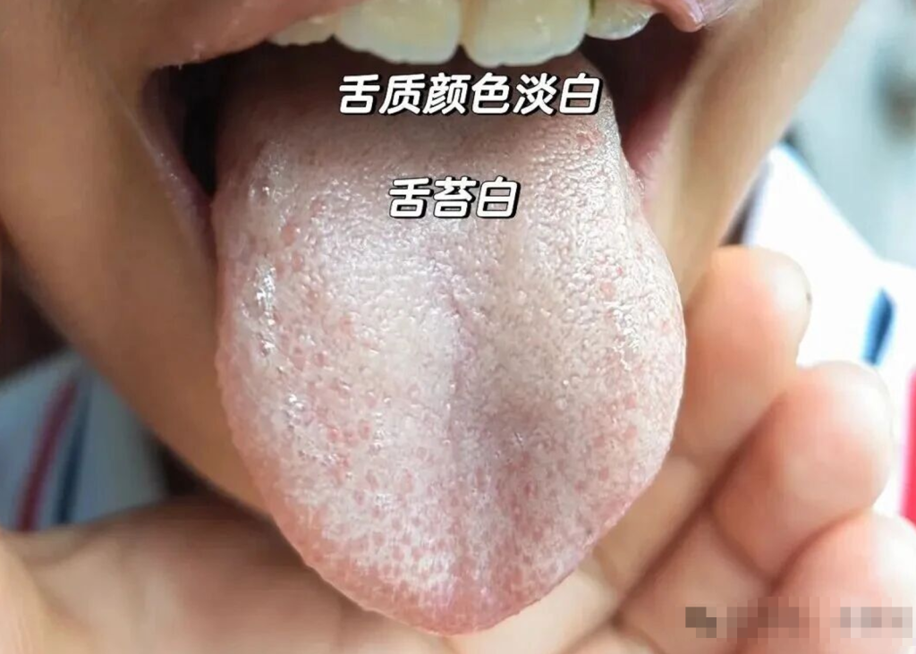 图片[4]-中医看舌头，到底在看什么？-智健家