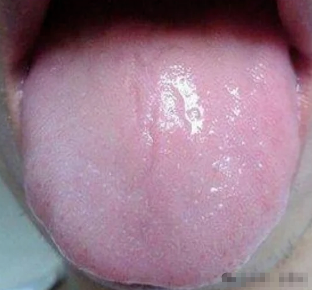 图片[5]-中医看舌头，到底在看什么？-智健家