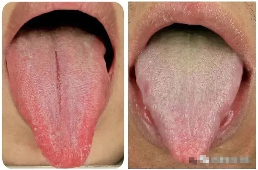 图片[6]-中医看舌头，到底在看什么？-智健家