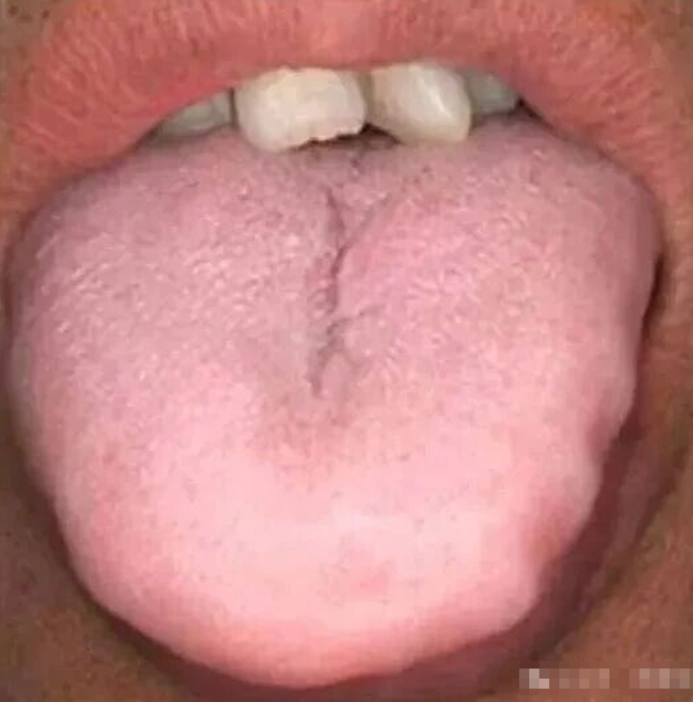 图片[7]-中医看舌头，到底在看什么？-智健家