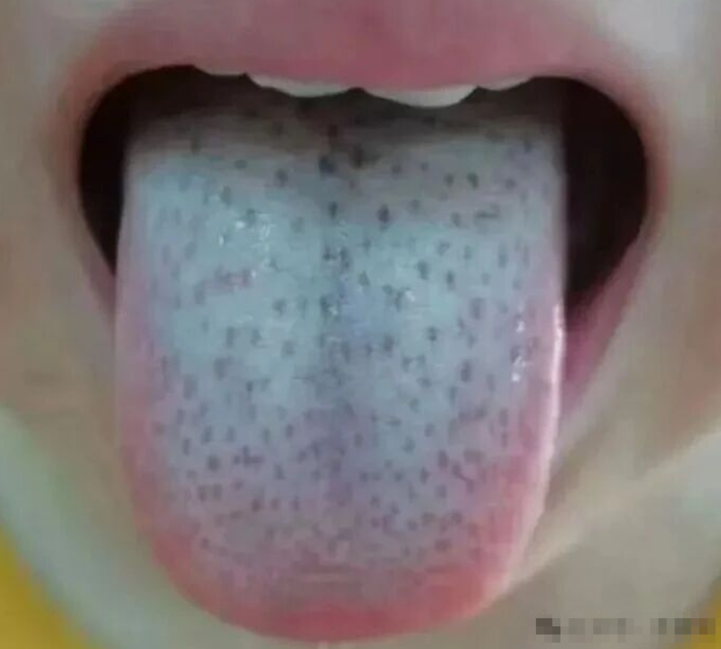 图片[8]-中医看舌头，到底在看什么？-智健家