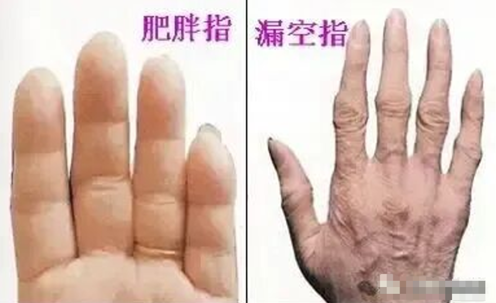 图片[3]-简单懂点手诊，帮你更加了解自己。-智健家