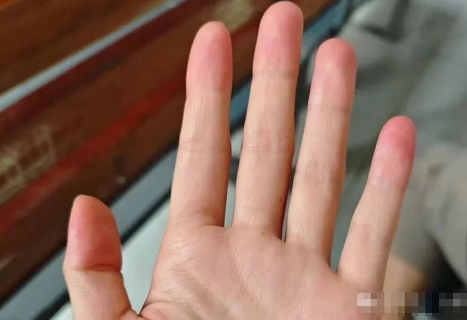 图片[4]-简单懂点手诊，帮你更加了解自己。-智健家