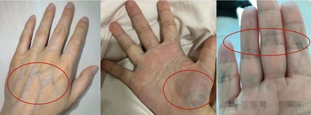 图片[6]-简单懂点手诊，帮你更加了解自己。-智健家