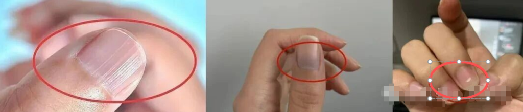 图片[7]-简单懂点手诊，帮你更加了解自己。-智健家