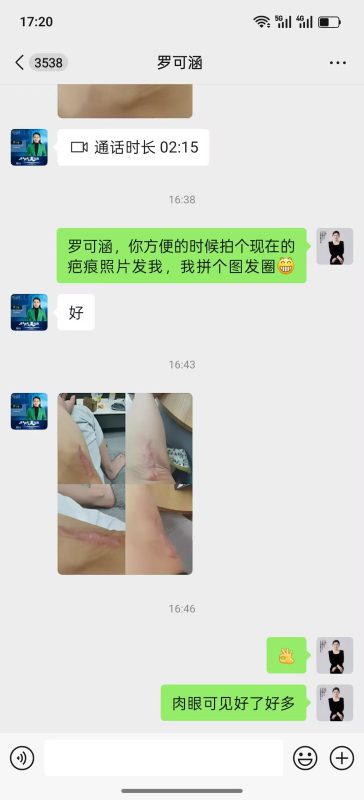 喝泰谦堂醋蛋液5个月，2年的疤痕平了好多，也不痒了-智健家