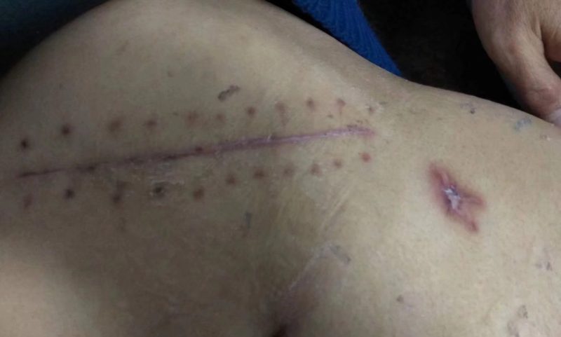 胰腺肿瘤 多次住院，自己亲身的经历，后悔没有早点用上泰谦堂醋蛋液-智健家