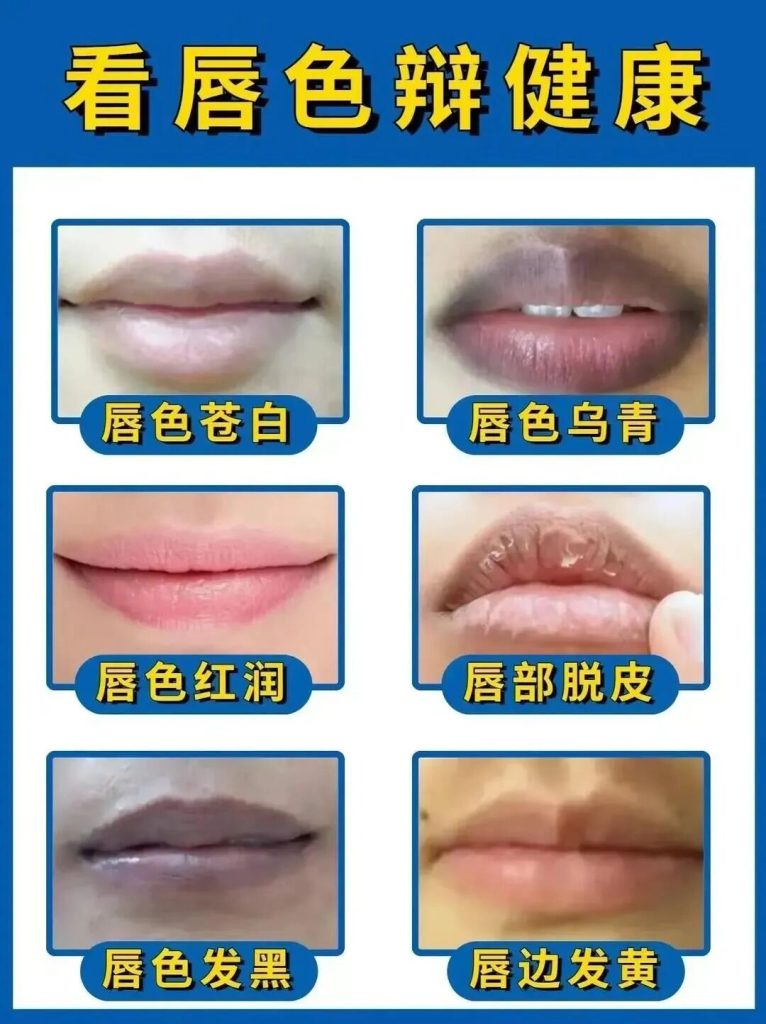 图片[1]-观唇色对应身体问题点-智健家