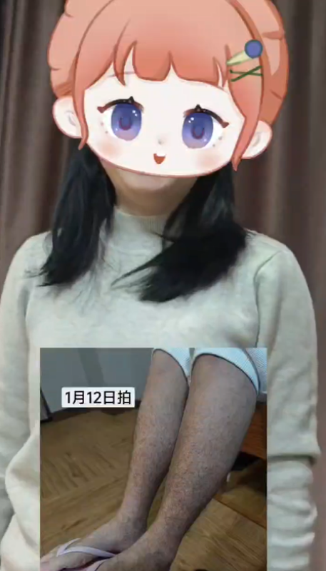 【视频】过敏性紫癜，用泰谦堂醋蛋归元液20天的效果-智健家