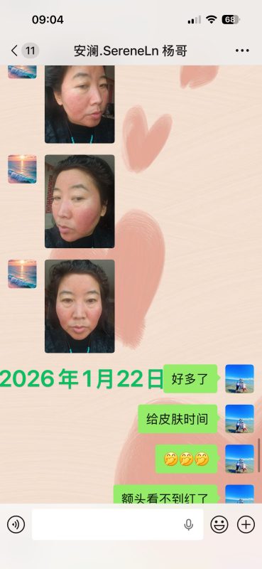 这个姐姐做水光1年多了，面部一直不好，起小脓点。使用醋蛋液一个月出头的效果！-智健家