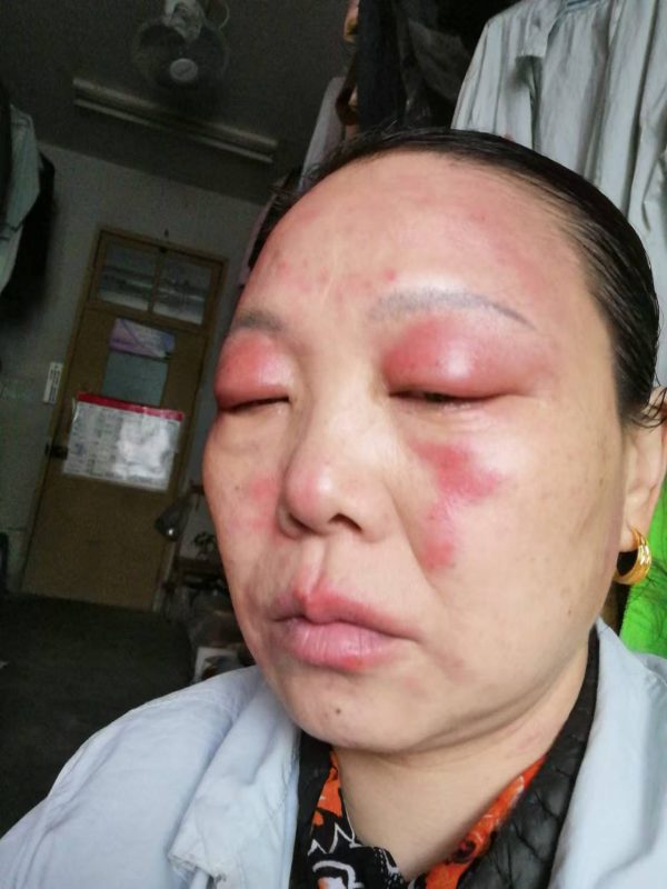 喝泰谦堂醋蛋液七年多了，全身百分之九十九都是很健康的-智健家