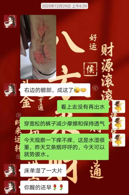 图片[9]-客户中焦淤堵下焦寒凉在中焦带脉位置艾灸之后显现出来的体质问题，后期用醋蛋液涂抹的修复过程-泰谦堂醋蛋液案例合集圈子社区-智健家