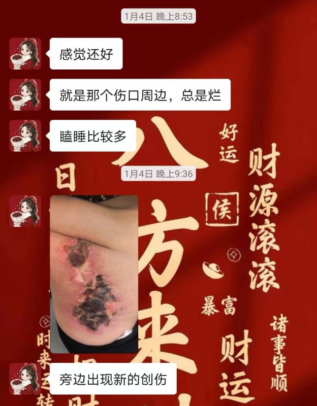 图片[18]-客户中焦淤堵下焦寒凉在中焦带脉位置艾灸之后显现出来的体质问题，后期用醋蛋液涂抹的修复过程-泰谦堂醋蛋液案例合集圈子社区-智健家