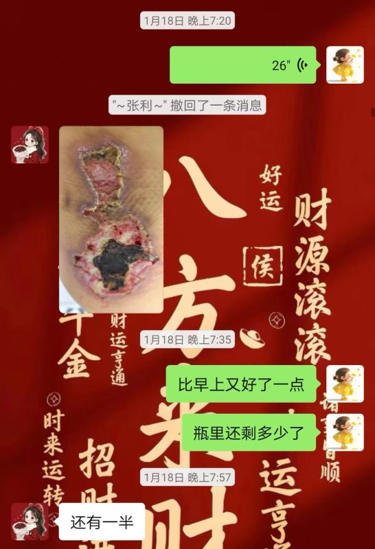 图片[22]-客户中焦淤堵下焦寒凉在中焦带脉位置艾灸之后显现出来的体质问题，后期用醋蛋液涂抹的修复过程-泰谦堂醋蛋液案例合集圈子社区-智健家