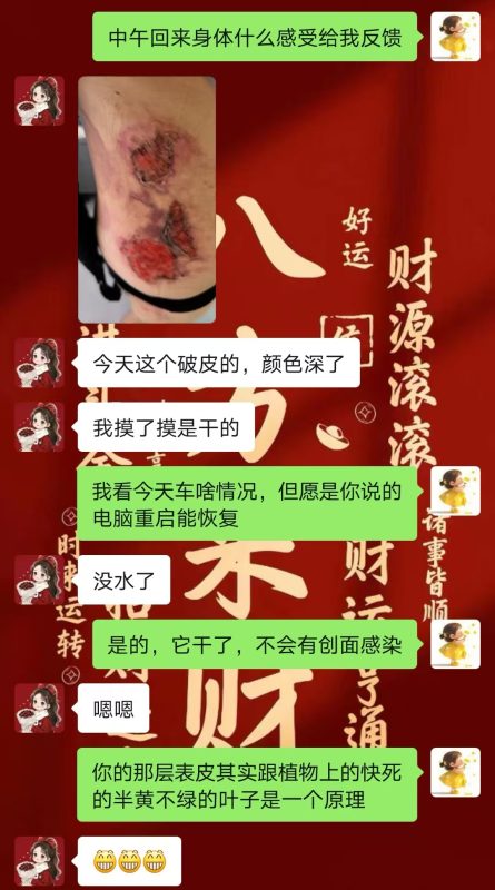 图片[13]-客户中焦淤堵下焦寒凉在中焦带脉位置艾灸之后显现出来的体质问题，后期用醋蛋液涂抹的修复过程-泰谦堂醋蛋液案例合集圈子社区-智健家