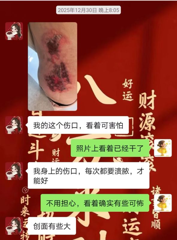 图片[14]-客户中焦淤堵下焦寒凉在中焦带脉位置艾灸之后显现出来的体质问题，后期用醋蛋液涂抹的修复过程-泰谦堂醋蛋液案例合集圈子社区-智健家