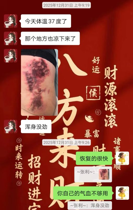图片[16]-客户中焦淤堵下焦寒凉在中焦带脉位置艾灸之后显现出来的体质问题，后期用醋蛋液涂抹的修复过程-泰谦堂醋蛋液案例合集圈子社区-智健家
