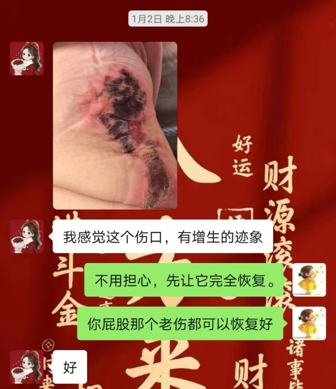 图片[17]-客户中焦淤堵下焦寒凉在中焦带脉位置艾灸之后显现出来的体质问题，后期用醋蛋液涂抹的修复过程-泰谦堂醋蛋液案例合集圈子社区-智健家