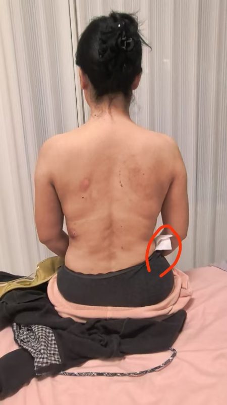 图片[8]-客户中焦淤堵下焦寒凉在中焦带脉位置艾灸之后显现出来的体质问题，后期用醋蛋液涂抹的修复过程-泰谦堂醋蛋液案例合集圈子社区-智健家