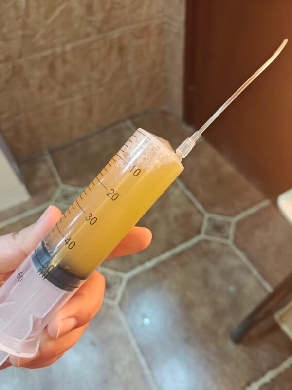 图片[5]-【音频･视频】喝醋蛋液，灌肠的外用使用方法，收藏一下-泰谦堂醋蛋液案例合集圈子社区-智健家