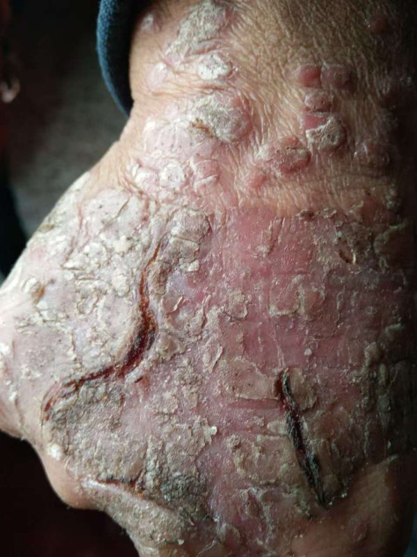 连喝带抹用了三瓶泰谦堂醋蛋归元液的效果-智健家