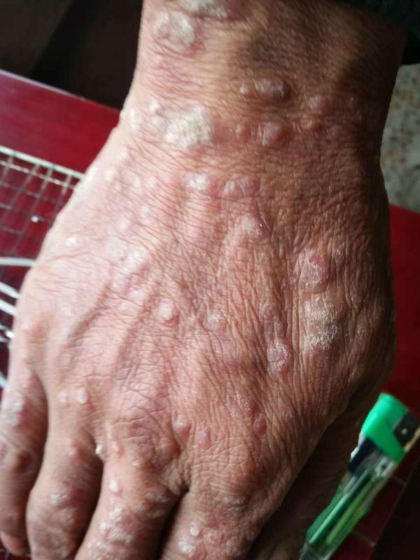 连喝带抹用了三瓶泰谦堂醋蛋归元液的效果-智健家