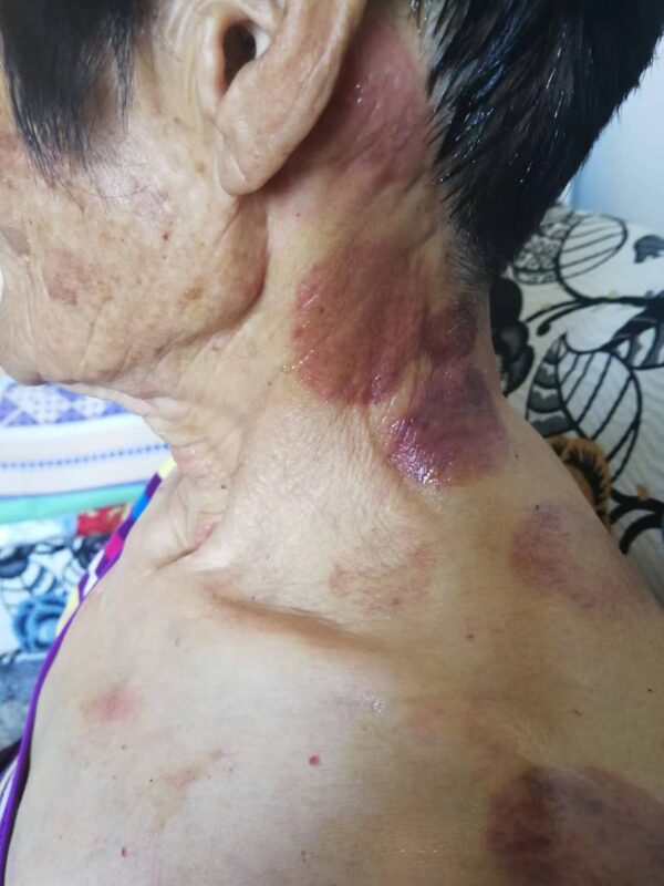 图片[16]-【视频】严重慢性病 一体多病，喝醋蛋液7年多恢复中的情况，受益泰谦堂醋蛋液的老人-泰谦堂醋蛋液案例合集圈子社区-智健家