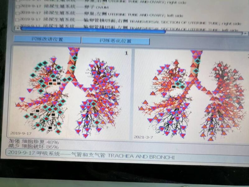 图片[17]-【视频】严重慢性病 一体多病，喝醋蛋液7年多恢复中的情况，受益泰谦堂醋蛋液的老人-泰谦堂醋蛋液案例合集圈子社区-智健家