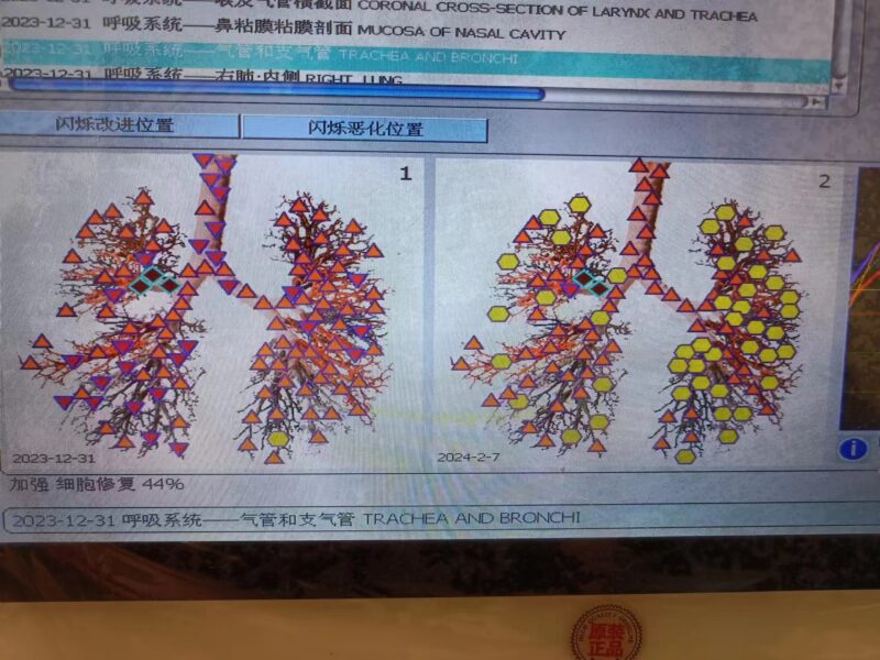 图片[18]-【视频】严重慢性病 一体多病，喝醋蛋液7年多恢复中的情况，受益泰谦堂醋蛋液的老人-泰谦堂醋蛋液案例合集圈子社区-智健家