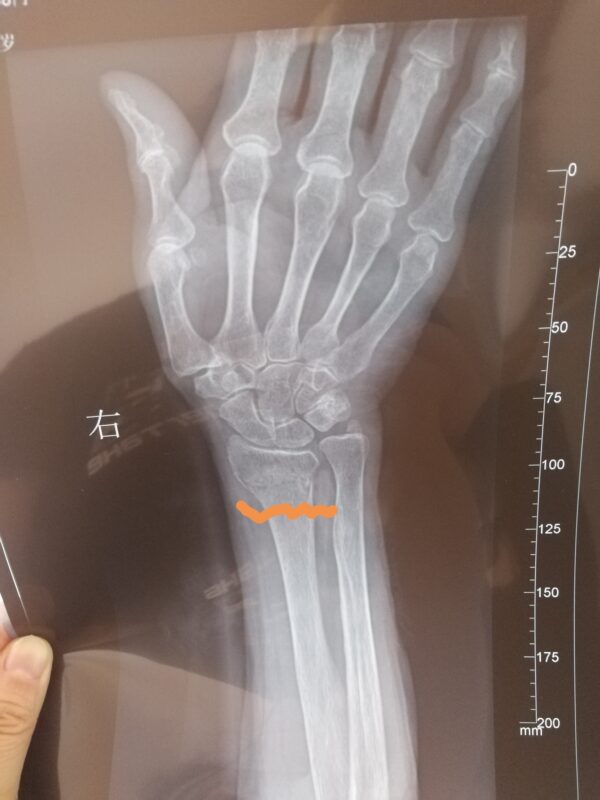 图片[10]-【视频】严重慢性病 一体多病，喝醋蛋液7年多恢复中的情况，受益泰谦堂醋蛋液的老人-泰谦堂醋蛋液案例合集圈子社区-智健家