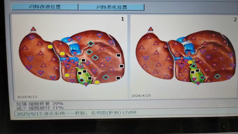 图片[5]-半年时光，好友坚持饮用醋蛋液真实反馈（心脏 大脑 颈动脉 动脉血管 肝胆）-泰谦堂醋蛋液案例合集圈子社区-智健家