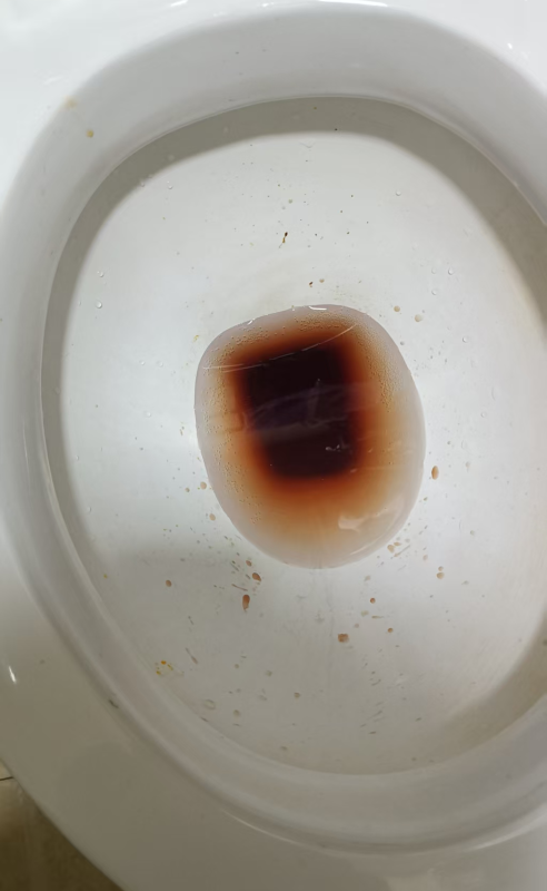 前列腺癌患者从2026年2月14日开始喝醋蛋液的分享，神奇的不敢相信-智健家