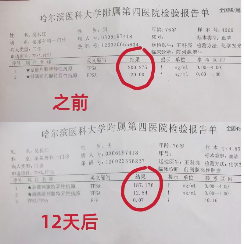 图片[7]-前列腺癌患者从2026年2月14日开始喝醋蛋液的分享，神奇的不敢相信-醋蛋归元液用户养生分享集圈子社区-智健家