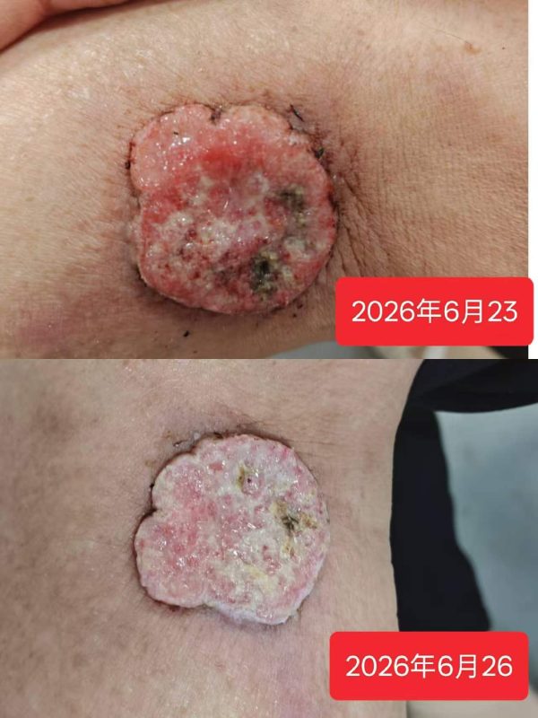 试用3天的效果[强]泰谦堂醋蛋液给力-智健家